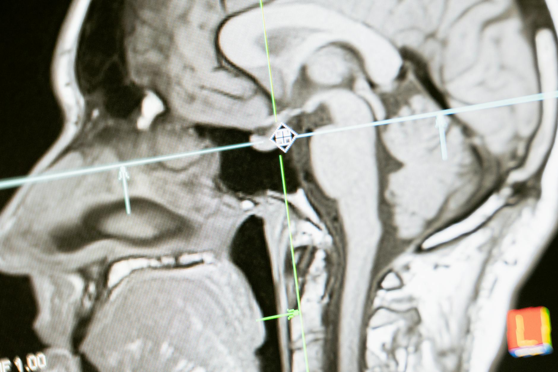 A diagram of the hippocampus, the brain region central to the neuroscience of memory, highlighted in the human brain.