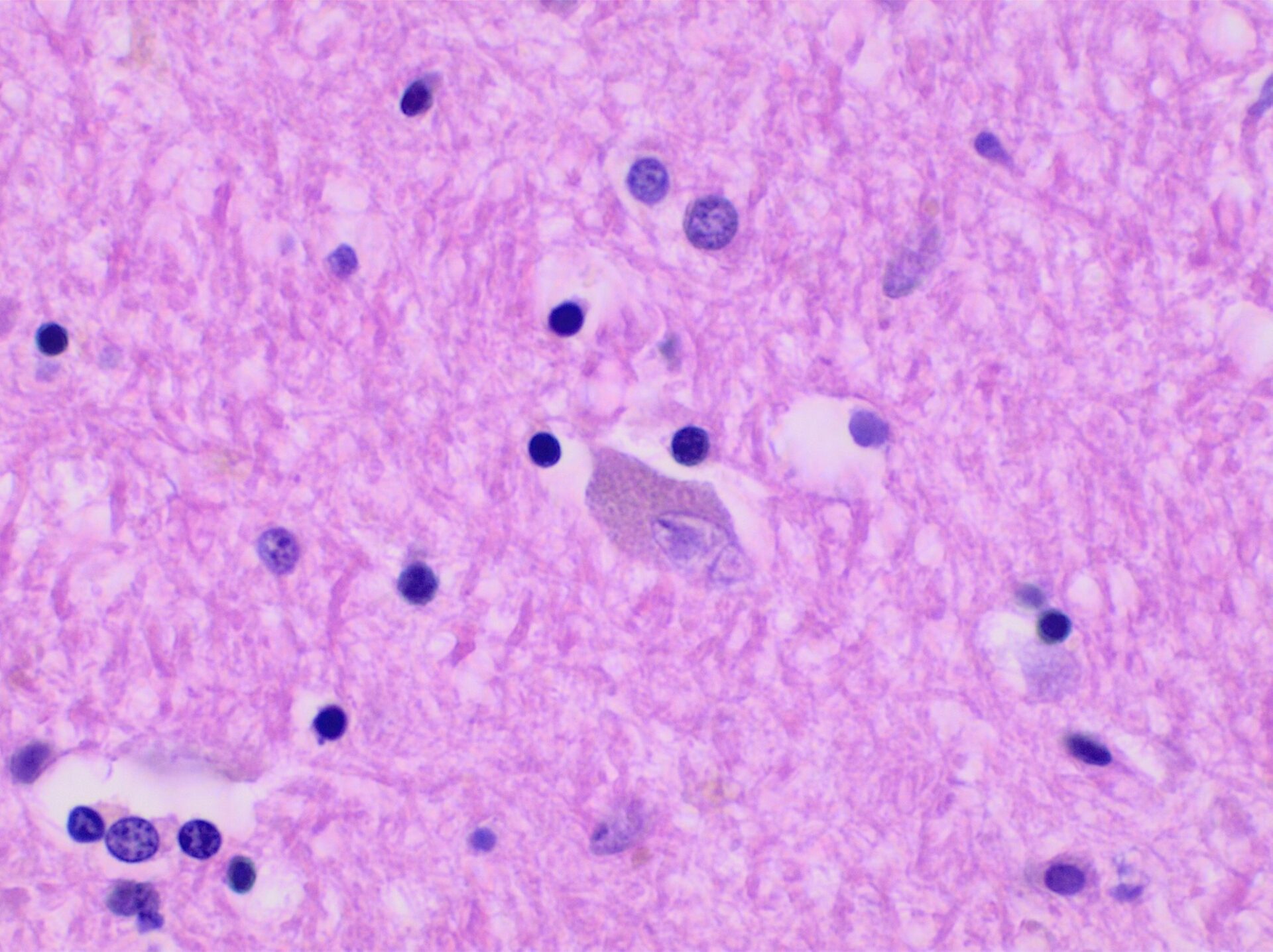 Microscope image of a single stained neuron with its branching processes. What are mirror neurons?