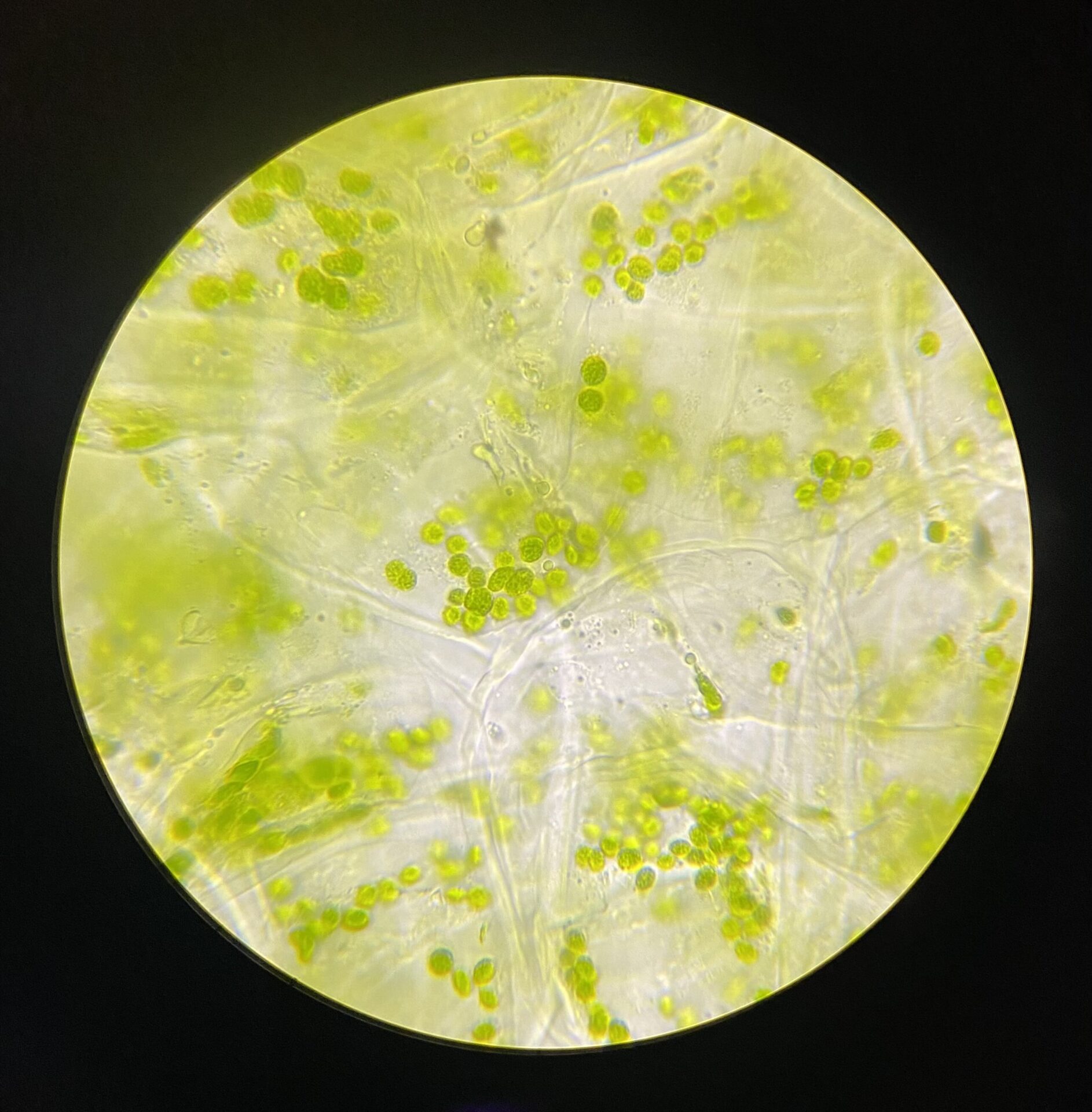 Microscope image of green chloroplasts inside plant leaf cells