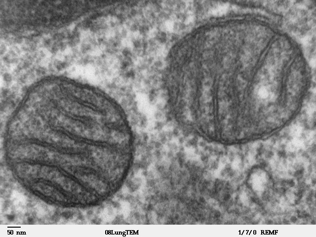 Electron microscope image of mitochondria inside a mammalian cell