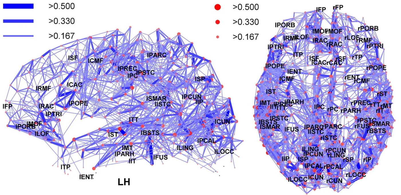 A network map of connections in the human brain