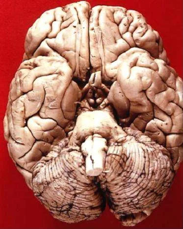 The Hard Problem of Consciousness: Why the Brain Alone Can’t Explain Your Inner Life