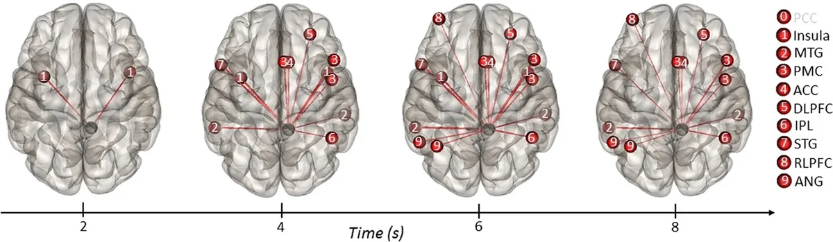 Brain imaging showing patterns of neural activity