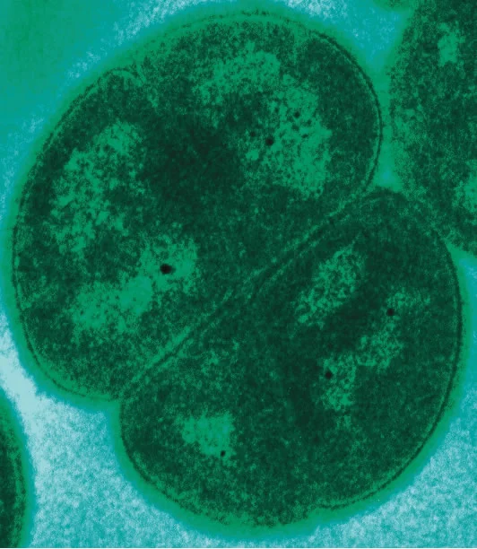 Transmission electron micrograph of Deinococcus radiodurans, the radiation-resistant bacterium nicknamed Conan the Bacterium, and a direct illustration of how microbes survive space radiation